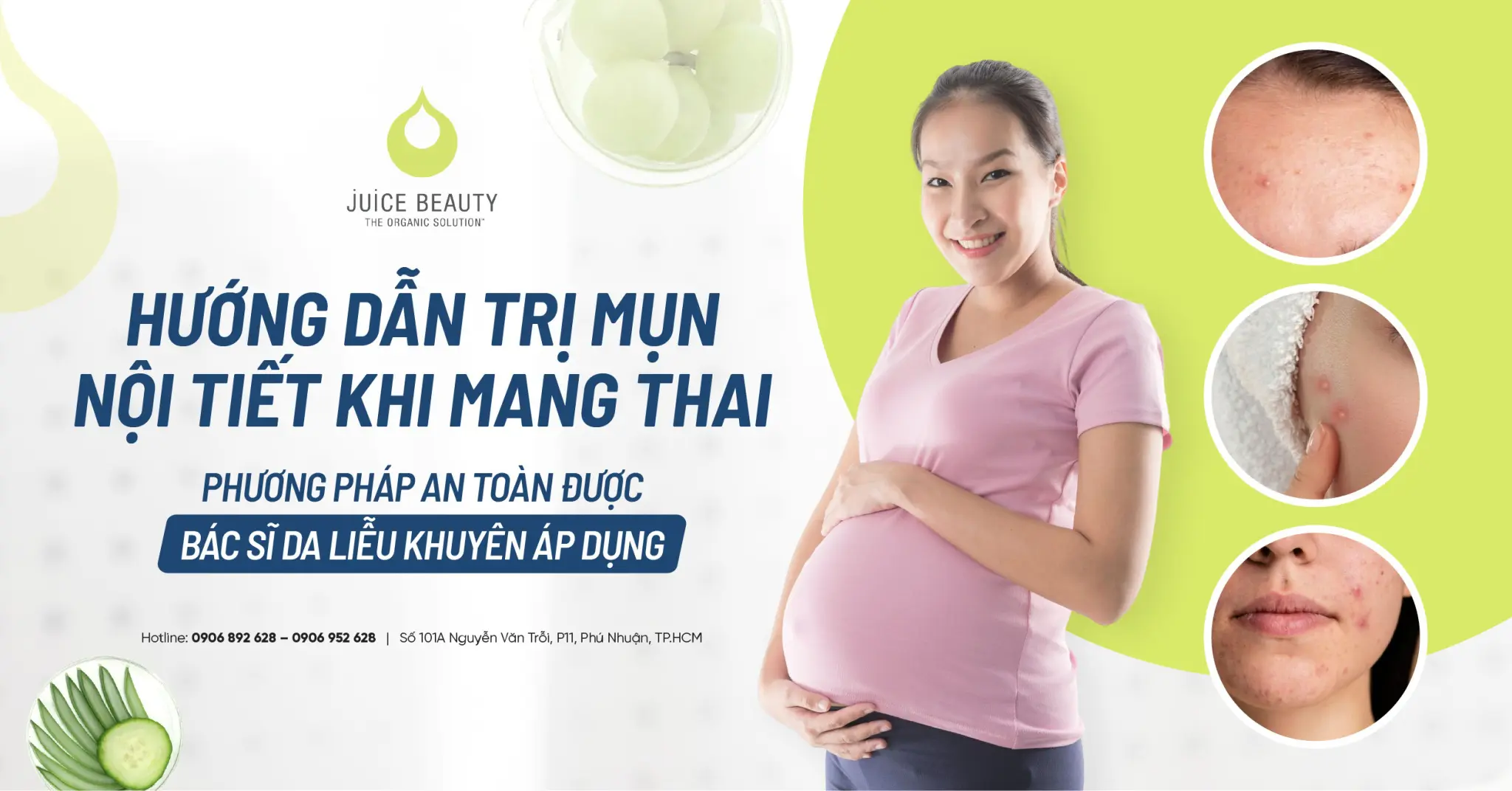 4. Chăm sóc da mụn trong thai kỳ